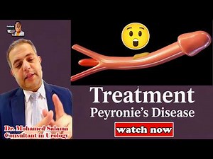 What Every Man Must Know About Peyronie's Disease RIGHT NOW ⚠️| ProHealthConsults