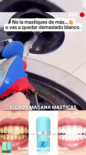 My dentist friend is the one who recommended this #SolidToothpaste to me. It really works well, especially for someone like me with yellow teeth and bad breath!