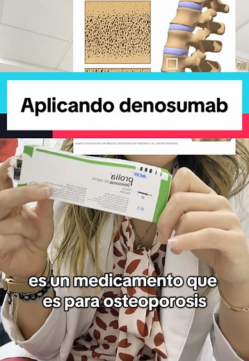 ¿Te van a aplicar Prolia (denosumab) para la osteoporosis? Te explico para qué sirve, cómo actúa y qué tan frecuentes (o raros) son sus efectos secundarios. Spoiler: ayuda a fortalecer los huesos y prevenir fracturas, y los efectos graves como la necrosis mandibular son extremadamente raros. Cuidar tus huesos es cuidar tu independencia. #Osteoporosis #Prolia #Denosumab #SaludÓsea #Geriatría
