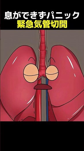 息ができずパニック：緊急気管切開