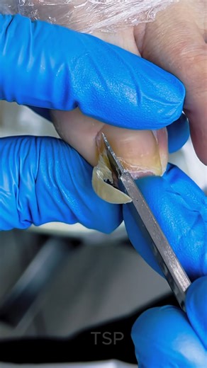 From messy to shiny ✨ | Pictures of Art