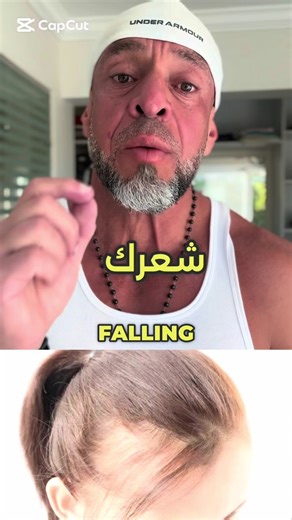 Understanding PCOS Symptoms and Diagnosis Guide