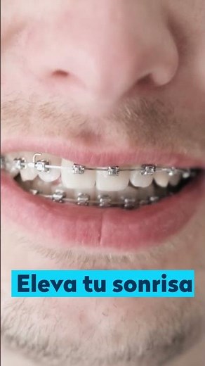 Cómo usar Waterpik Ultra Plus | Tutorial paso a paso​