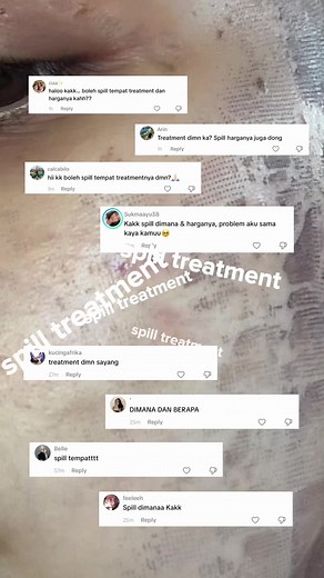 Rejuran CO2 Laser: Airin Skin Clinic Treatment