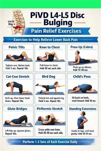pivd L4-L5 disc bulging pain relief exercises #backpain