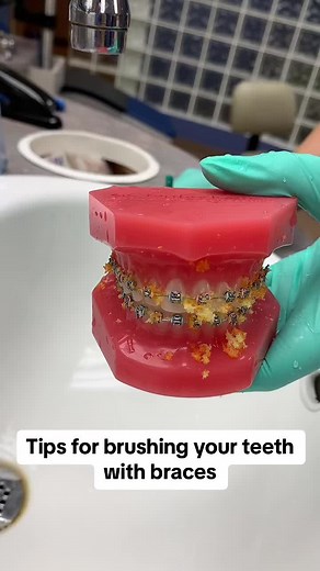 Hamilton_orthodontics on TikTok