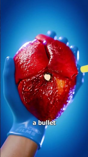 How An Autopsy Is Performed 😨