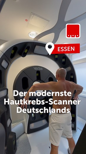 Der neue Haut-Scanner „Vectra WB360“ steht in den Evangelischen Kliniken Essen Mitte 🏥 Er soll bei der Diagnose von Hautkrebs helfen. Prof. Ingo Stoffels , Direktor der Klinik für Dermatologie, hat ihn uns vorgestellt. Jeder Versicherte ab 35 Jahren kann sich alle zwei Jahre auf Hautkrebs untersuchen lassen🔎 Die Kontrolle mit dem neuen Vectra-Scanner übernehmen bisher nur private Krankenkassen. Nur vereinzelt wird sie von gesetzlichen Kassen bezahlt. Die Untersuchung kostet rund 200 Euro. | Ra