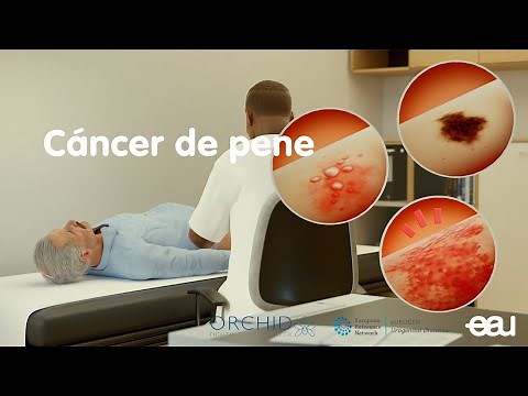 Cáncer de pene