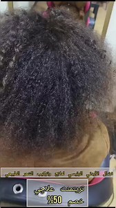 33 reactions | #hairtreatment# نضال الأردني لعلاج وتركيب الشعر الطبيعي #تريتمنت علاجي..جلسات ترطيب عميق علي شعرك..جلسات ترميم بجميع أنواعها ### #Treatment #hairstyle #arganoil | مركز نضال الاردني لتركيب الشعر | Facebook