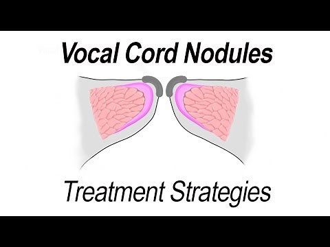 Vocal Cord Nodules Treatment Strategies (Voice Therapy & Surgical Removal)