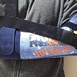 Velpeau Arm Sling Shoulder Immobilizer with Waist Strap, Ventilated & Breathable Design, Arm Support Brace for Shoulder, Rotator Cuff, Elbow, Hand injury (Mesh Version, Blue, Left, S: Bust 25-30.5″)
