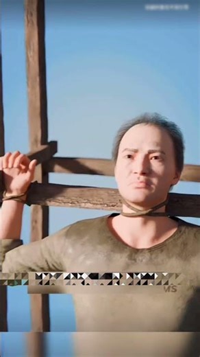 Cavity Removal and Tooth Filling Process