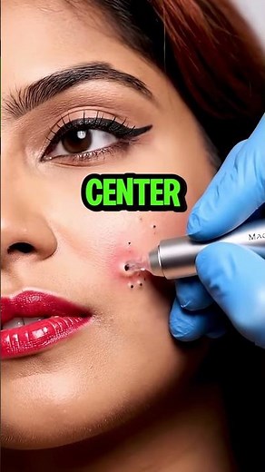 Her Perfect Makeup Was a LIE... Hiding This MONSTER Pimple Pop!