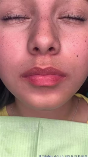 Effective Teeth Cleaning Process for Optimal Dental Health