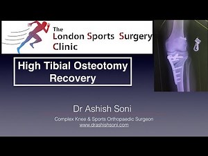 High Tibial Osteotomy recovery