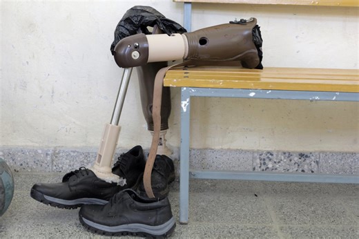 Scientists say we have been wrong about phantom limbs for decades