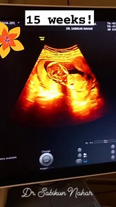 33K views · 610 reactions | 15 weeker. Breech baby. | Dr. Sabikun Nahar | Facebook