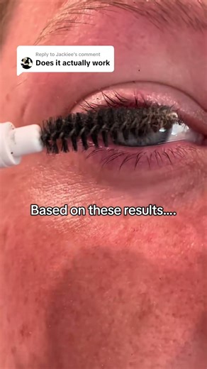 Prostaglandin-Free Lash Serum for Fuller Lashes! #lashes #lashserum