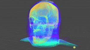 Unity で DICOM 画像をレンダリングしてみる - 凹みTips