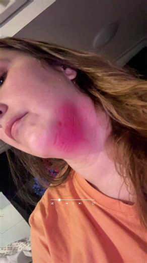 When i get stung by a bee 🥹😩