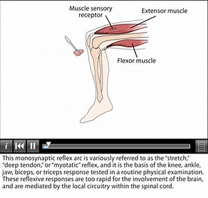 The stretch reflex on Make a GIF