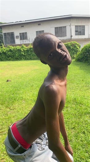 Dancing frog 🐸 #fyp #viral