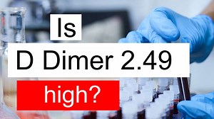 Treatment and symptoms of D Dimer 2.49 ug/mL | Diet for high D Dimer level 2.49 ug/mL