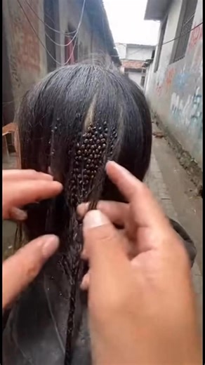 Extreme tick infestation found. This video is for hygiene awareness and prevention only. Safe demonstration no medical advice. #ticks #lice #hygieneawareness #publichealth #awarenessvideo | Ticks Lice