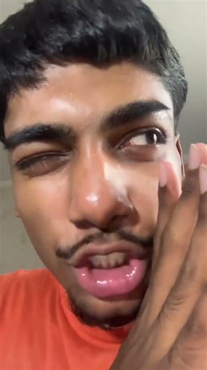 Tuto comment ne plus avoir des comédons fermés #glowup #looksmaxxing #pourtoi #fyp