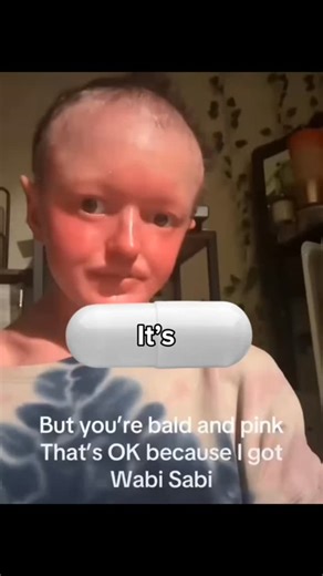 looksmaxer | Its not over | Instagram