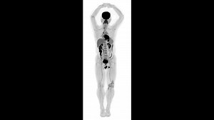New 3D body scanner uses 40 times less radiation than PET scans