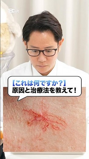 What Are Those Red Patches on Your Skin?