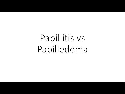 Papillitis vs Papilledema - Ophthalmology