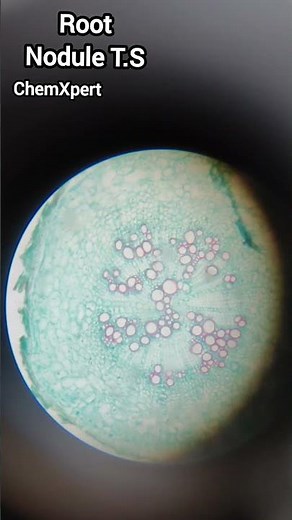 Root Nodules T.S | A transverse section of Root Nodule | Biology Practical