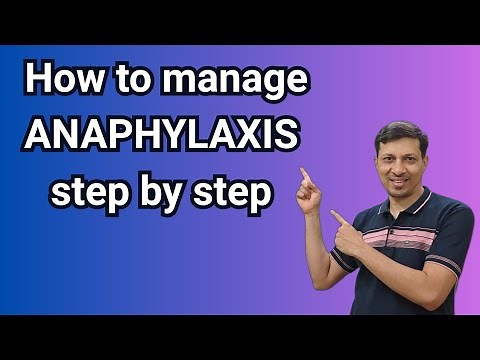 Anaphylaxis in Emergency | Dos & Don’ts Every Young Doctor Should Know