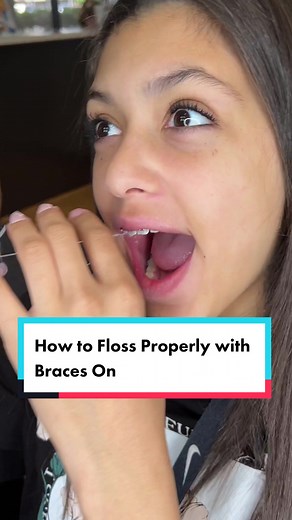 Proper Technique: Flossing with Braces for Effective Oral Care