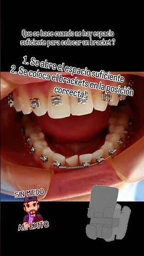 Como se apertura un espacio y se coloca un bracket?