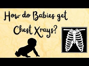 How Do Babies Get X-Rays?
