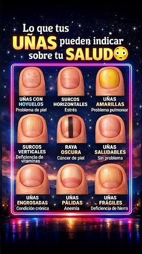Tus Uñas Revelan Tu Salud 😳 ¿Sabías Esto?