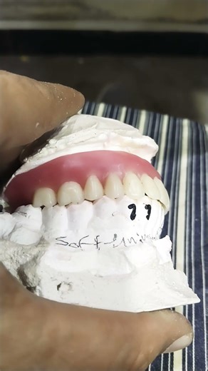 Teeth Arrangement Of Upper Soft Lining Complete Denture 😁😁😁#softdenture #completedenture #viralvideo