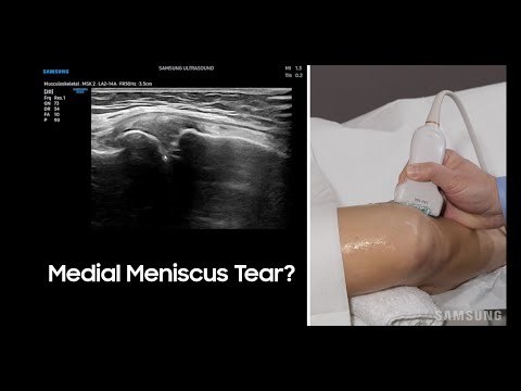 Mastering Knee Ultrasound - A Comprehensive Guide
