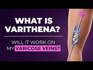 Varithena Treatment Explained | Non-Surgical Option for Varicose Veins