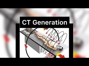 CT Generation | Detectors | X-ray tube | slip Ring Technology