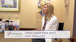 Treatment of the Facial Folds (MLF)