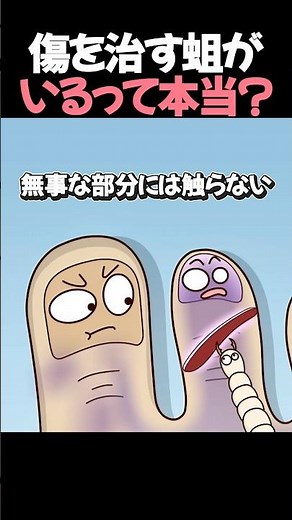 傷を治す“医療ウジ虫”って本当にいるの？