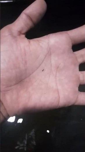 😱🚿tiny bugs living in your shower 🐜😳