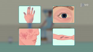 Video: Changes in Skin Color: Clinical Perspectives