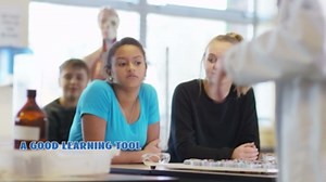 Periodontal Disease Model, Typodont Periodontal Disease, Dental Teeth Model for Dental Tooth Anatomy Study, Doctor-Patient and Oral Care Education