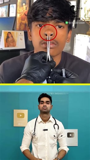 Dr. Isacc Abbas | Septum piercing is NOT just a style choice — it’s anatomy. The safest place to pierce is the membranous septum which is thin and minimally... | Instagram